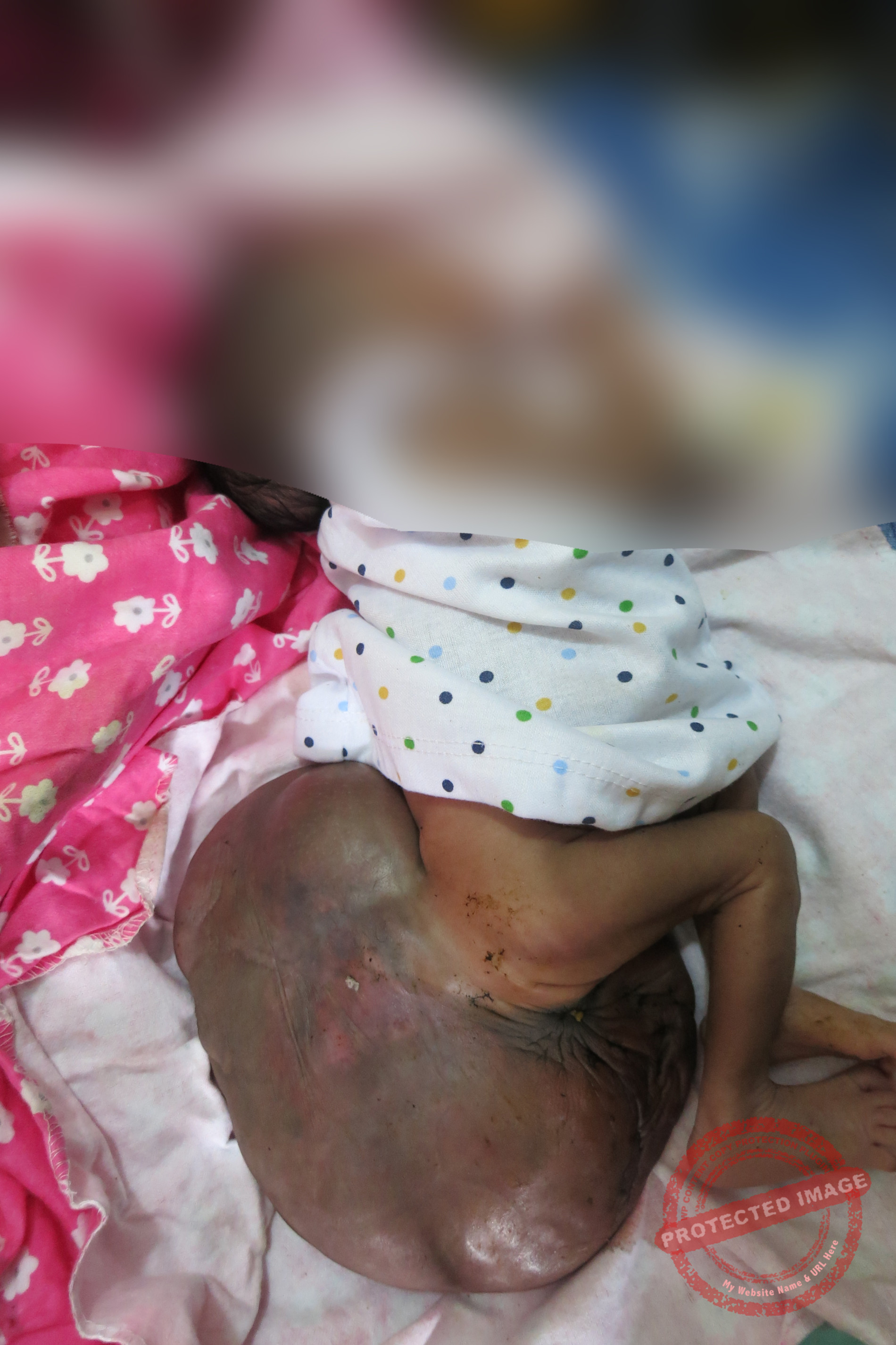 Mother of deformed newborn appeals for help