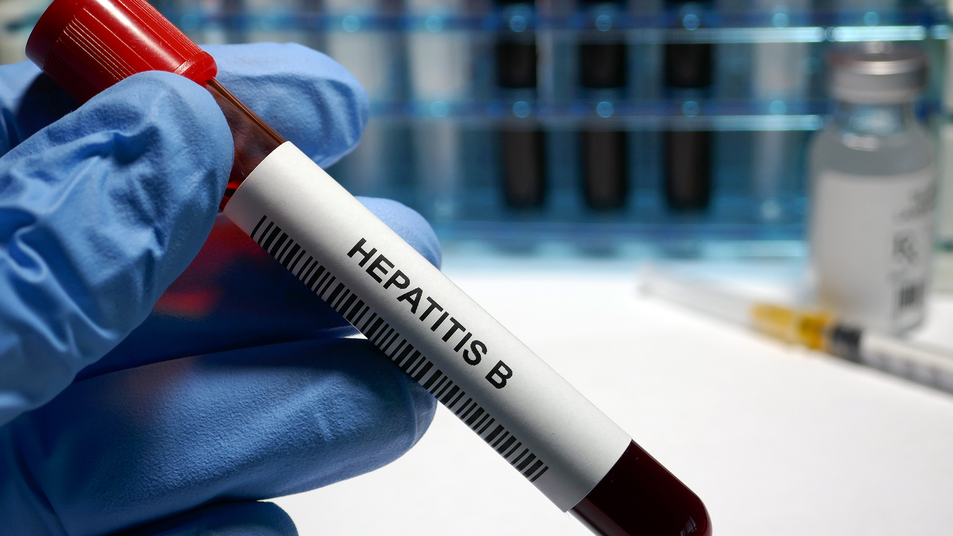 Why gov’t has ‘not invested’ in Hepatitis eradication
