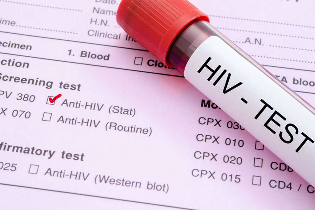 Husbands challenged to accompany pregnant wives to clinic for HIV test