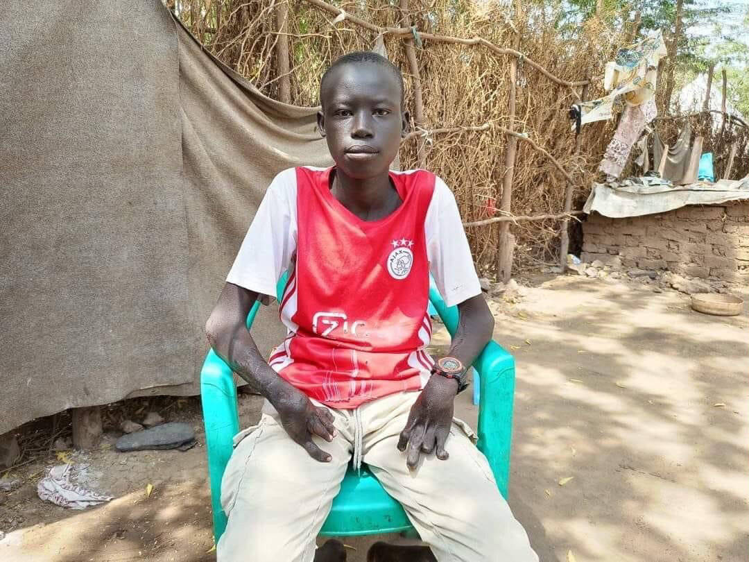 South Sudanese boy with disability among the best pupils in Kenya