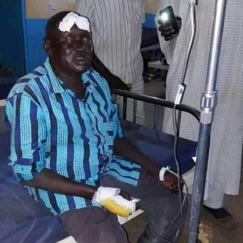 We have no cars, we walk on foot,” says injured SPLM-IO state minister in Aweil