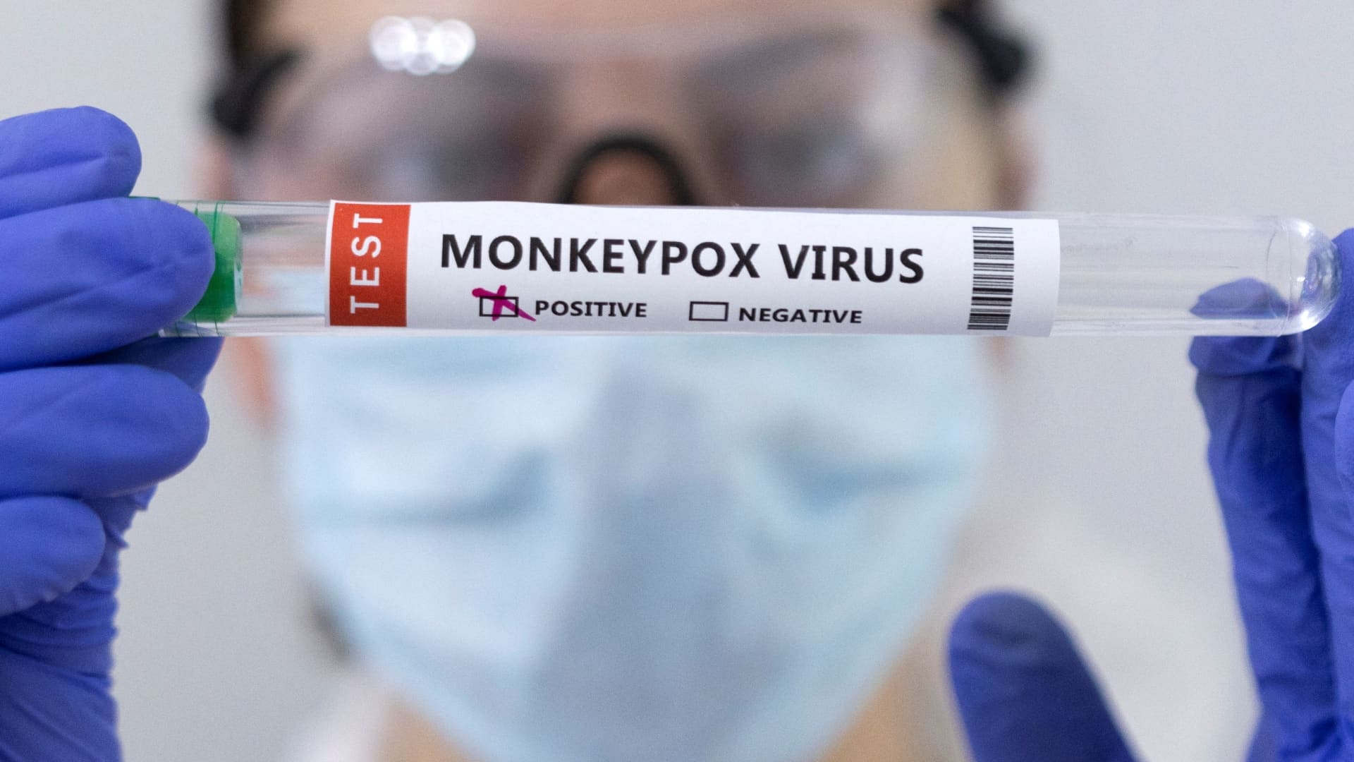 Gov’t investigating Kapoeta monkeypox rumors