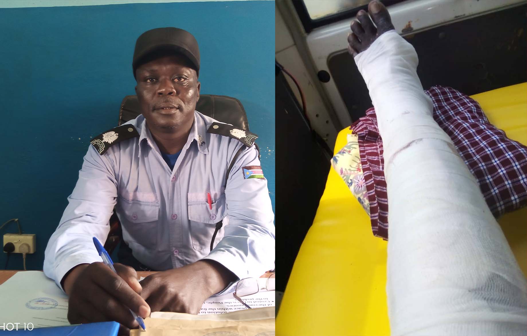 Nimule Police Inspector shot in leg amidst protest