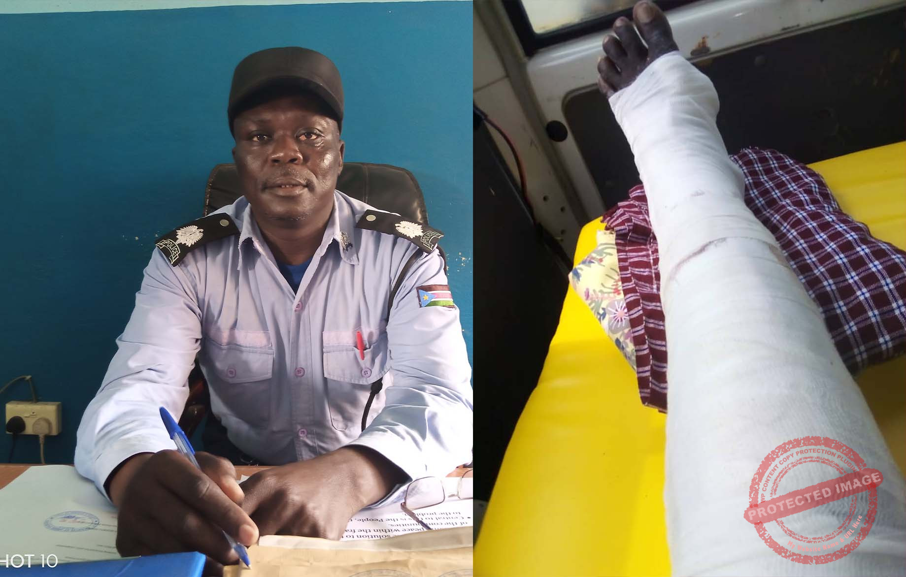 Nimule Police Inspector shot in leg amidst protest