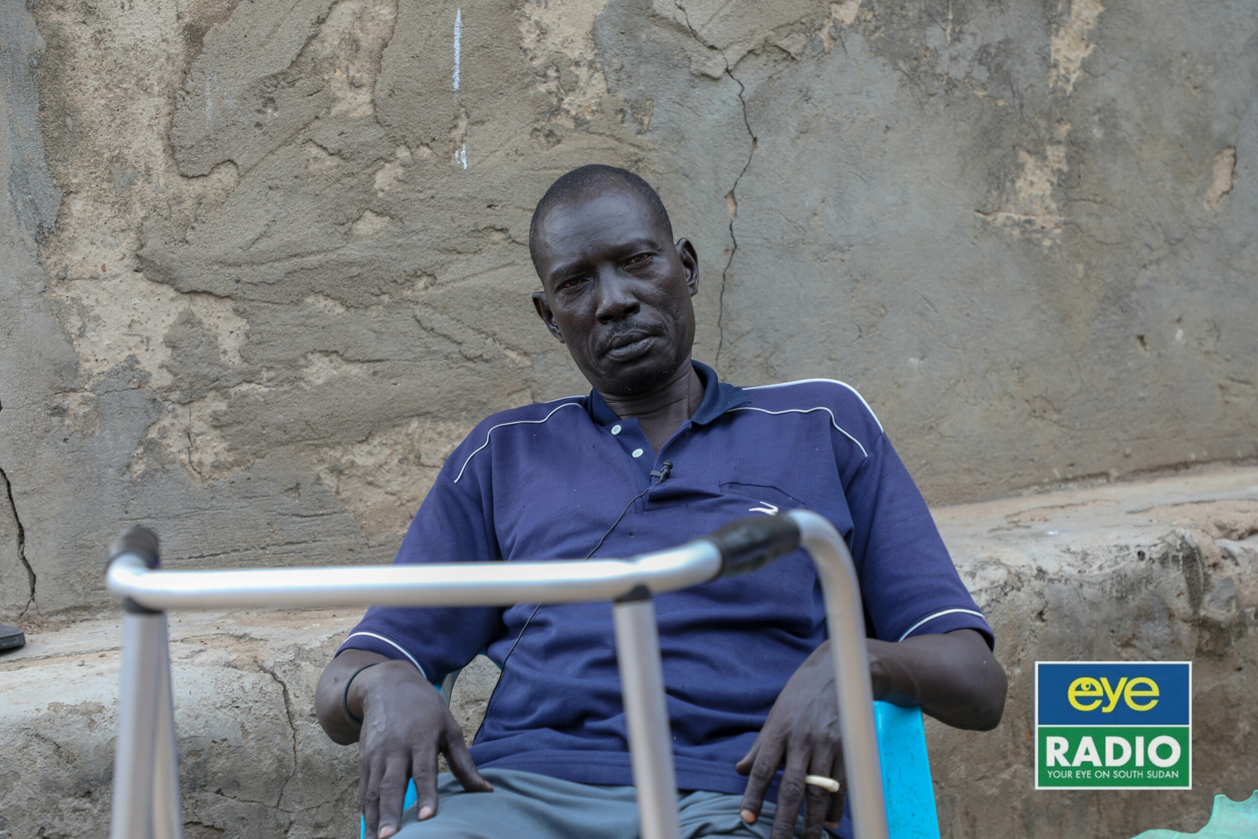 33 years later, wounded SPLA war veteran still lives with bullets in his body