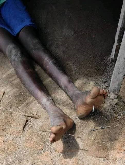 Kwajok mother arrested for nailing her teen daughter’s feet