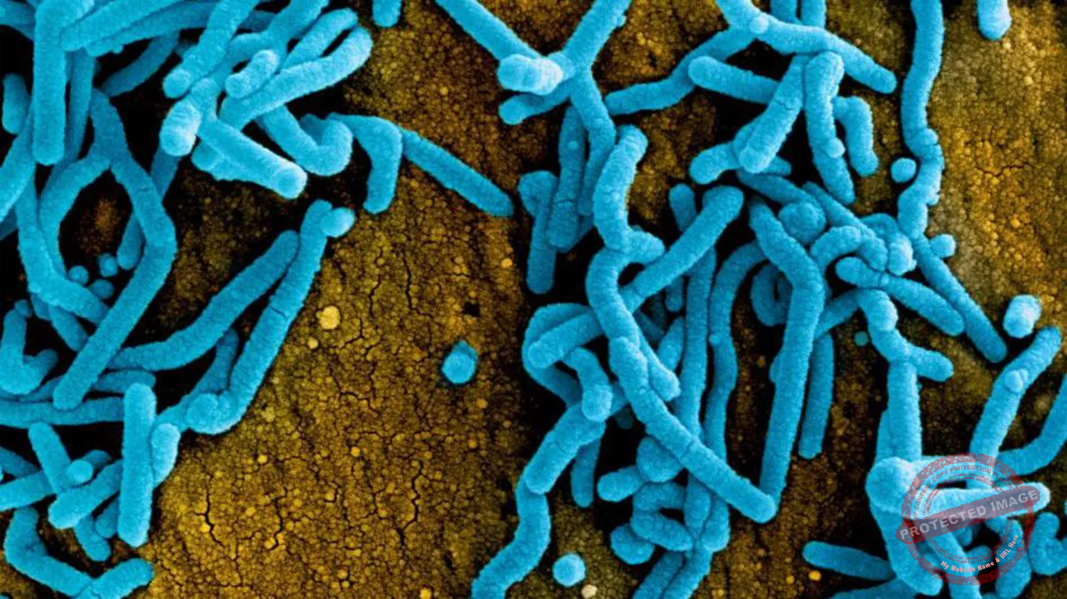 Risk of Marburg outbreak in Tanzania spreading to neighbors is high -WHO