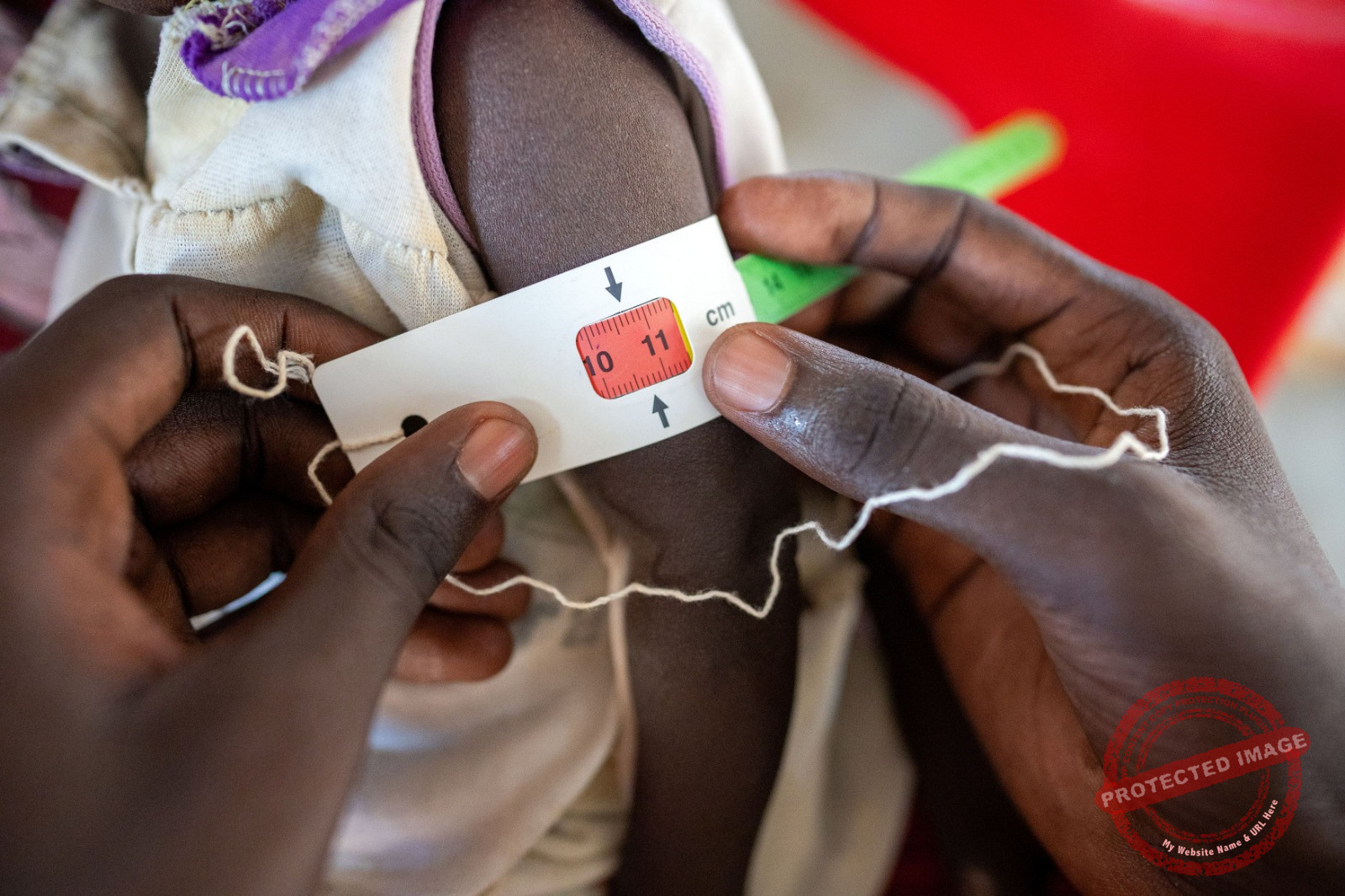 Hundreds of thousands of malnourished children at risk amid escalating violence