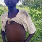 Orphan boy battling old injury in Tonj East seeks medical support