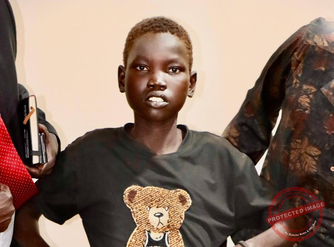 Manyang Machar recovering after successful surgery – Family