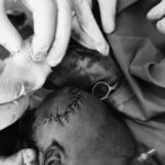 Four-day-old infant survives head gunshot, loses both parents in deadly cattle camp attack in Tonj East